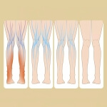 Elektrinis blauzdos masažuoklis, 7.5w