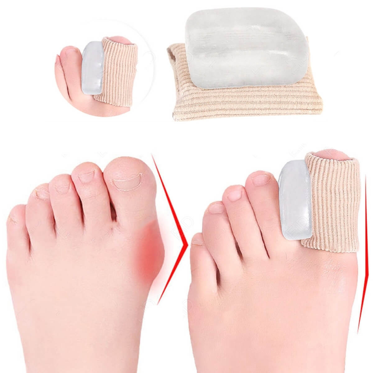 Kojos piršto įtvaras, 2 vnt.