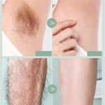 Plaukelių šalinimo peiliukas