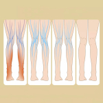 Elektrinis blauzdos masažuoklis, 7.5w